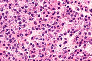 Head-Neck-Pathology