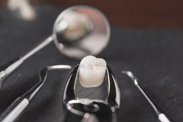 Teeth-Extractions